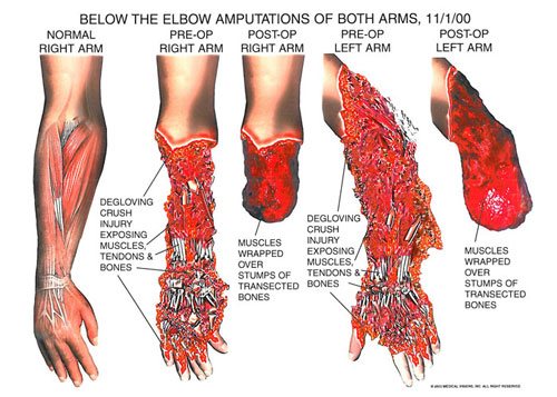 arms_2 - Owens & Mulherin