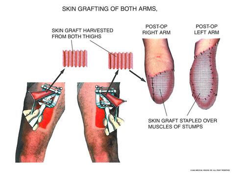 arms_3 - Owens & Mulherin