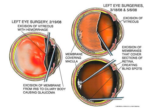 eye_1 - Owens & Mulherin